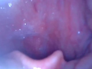 epiglottis, uvula, kink, tongue