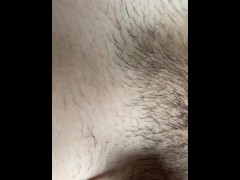 アソコの毛　脱毛