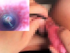 【閲覧注意】尿道探検2　内視鏡を入れて亀頭責めをしたらどうなる？ - Screenshot 15 of 16 - Point Of View