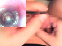 【閲覧注意】尿道探検3　射精オーガズム時の尿道内部の様子 - Screenshot 15 of 16 - Inside Urethra