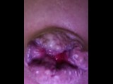 Sissy prolapse extreme