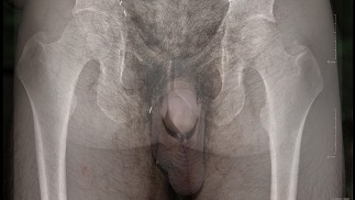 Plus que la peau profonde - une vue à rayons X de ma bite!!