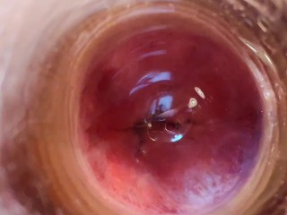 30. my Lucky Ass. Peniscope