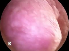 超小型カメラで感じる乳首を愛撫しながら接写しました。 - Screenshot 15 of 16 - Close Up