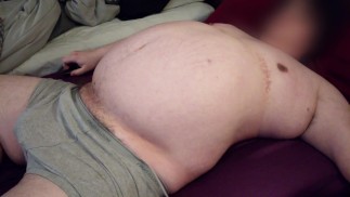 使用氦气和压缩机进行腹部充气