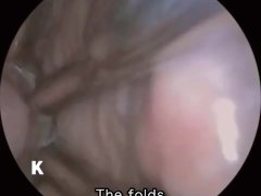 【超小型カメラ撮影】クリトリスのドアップからタンポンの引き抜き、そして拡張器を挿入して膣内の観察、最後は大量放尿 - Screenshot 10 of 16 - Japanese