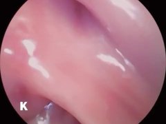 【超小型カメラ撮影】クリトリスのドアップからタンポンの引き抜き、そして拡張器を挿入して膣内の観察、最後は大量放尿 - Screenshot 11 of 16 - Mature Woman