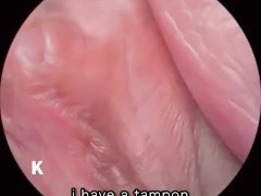 【超小型カメラ撮影】クリトリスのドアップからタンポンの引き抜き、そして拡張器を挿入して膣内の観察、最後は大量放尿 - Screenshot 4 of 16 - Japanese