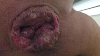 Выдавливаю сперму из моей свободной дырочки