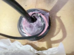 アナルバルーンでおなかパンパンにして一気に空気を抜くのが気持ちいい - Screenshot 13 of 16 - アナル 開発