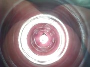 Preview 1 of Urethral masturbation with an endoscope.