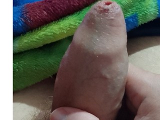 我的微型阴茎 10cm