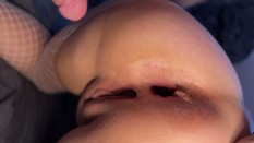 Fart