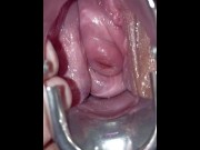 Preview 2 of Speculum cervix orgasm