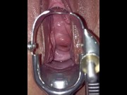 Preview 5 of Speculum cervix orgasm