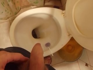 peeing after 24 hours without peeing