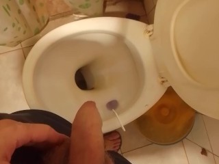 мочеиспускание через 24 часа без мочеиспускания