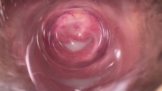 Het heetste poesje spreiden en interne camera in Mia's romige vagina
