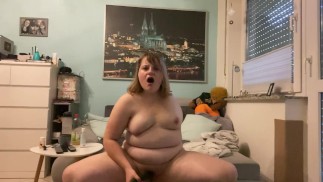 Amputee