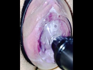 verified amateurs, vertical video, pussy pump, prolapse