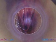 Preview 3 of Petite girl Melissa put camera deep inside in her wet creamy pussy (Full HD pussy cam, endoscope)
