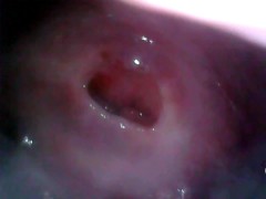 LittleCerika View Inside My pussy, endoscope