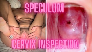 Hot Lady Allows Us To Examine Her Cervix And Open Her Up With A Speculum