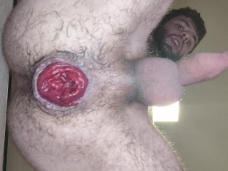 Showing Big Prolapse after Double Fisting myself