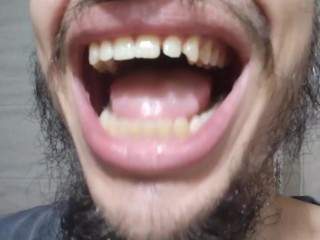 Dientes Sucios y Toungue Sucio