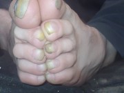 Toenails have gotten Long and Ugly - Pornhub Gay
