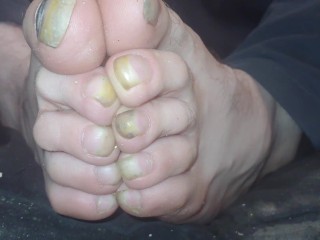 Toenails have gotten Long and Ugly