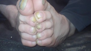 Le unghie dei piedi sono diventate lunghe e brutte