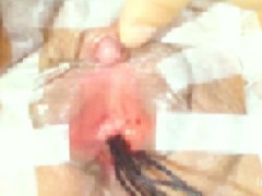 クリトリスを吸引したり、針を刺したり、バイブで責めたり、尿道を綿棒で遊んだり…♪ 11/16