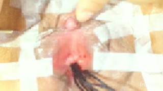 Using A Cotton Swab To Play With The Urethra Injecting A Needle Torturing With A Vibrator Sucking The Clitoris Etc
