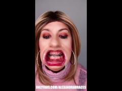 Braces fetish! See Alexandra Braces with an open mouth expander