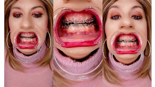 Alexandra Braces zeigt ihre Zahnspange