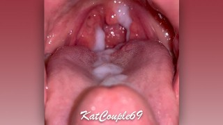Close-Up View Of The Throat Canal