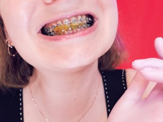 braces, teeth, fetish, jelly bears