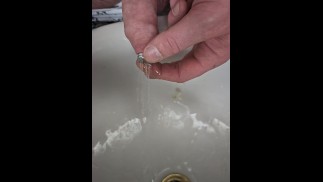 Зондирование отверстия мочи с помощью спринклерного стержня