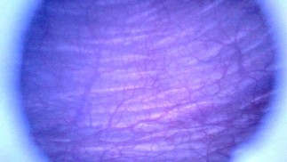 Beautiful inside POV of my full Bladder with the Endoscope - Preview