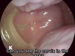 【超小型カメラ】クスコで膣の中を探検してみました。 - Screenshot 8 of 16 - Cusco