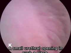 【超小型カメラ】クスコで膣の中を探検してみました。 - Screenshot 9 of 16 - Japanese