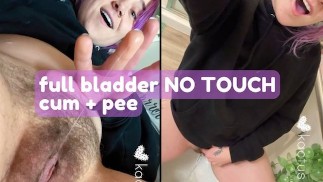 膀胱充盈 NO TOUCH 暨