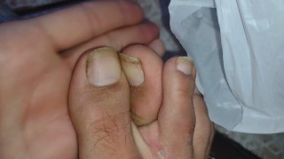 dedo del pie de cerdo uñas disfrazando pies
