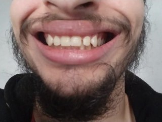 Dentes Sujos Toungue Sujos