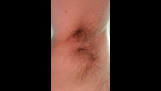 Волосатые ямки