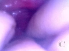 Endoscope inside POV of my juicy Ass getting fisted deeply - Preview