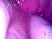 Preview 3 of Endoscope inside POV of my juicy Ass getting fisted deeply - Preview