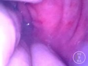 Preview 5 of Endoscope inside POV of my juicy Ass getting fisted deeply - Preview