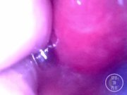 Preview 6 of Endoscope inside POV of my juicy Ass getting fisted deeply - Preview